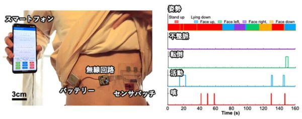 常時健康管理に向けたエッジAI型センサパッチ